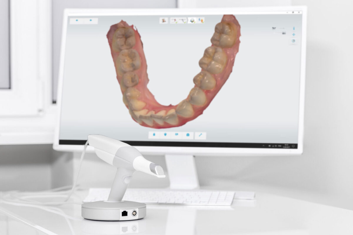 Dentalscanner