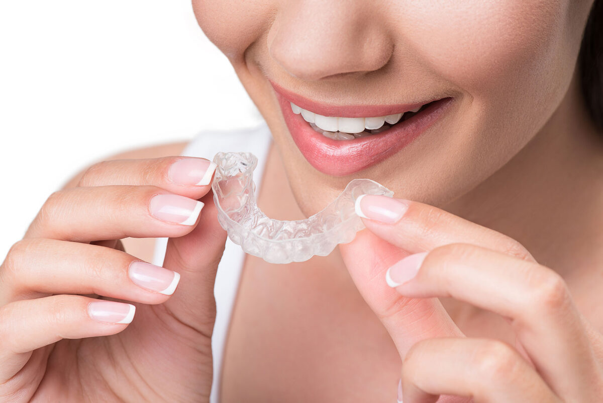 Alle ein bis zwei Wochen erhalten Sie eine neue Invisalign-Schiene