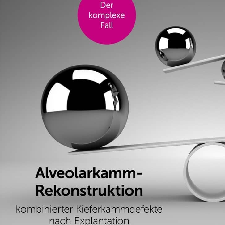„Alveolarkammrekonstruktion kombinierter Kieferkammdefekte nach Explantation“ | dzw.de