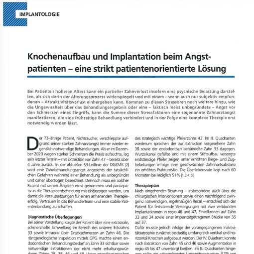 Knochenaufbau und Implantation beim Angstpatienten – eine strikt patientenorientierte Lösung
