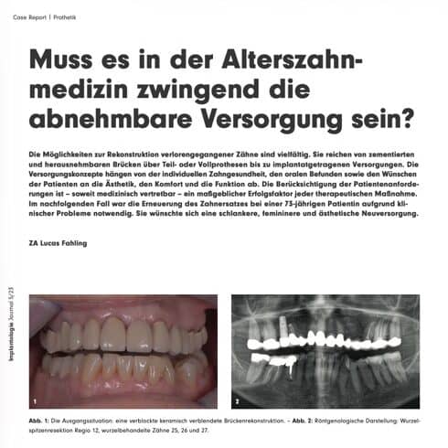 Alternativen und Potenziale der Alterszahnmedizin – Abnehmbare Versorgung zwingend notwendig?